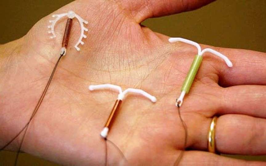Dispozitivele intrauterine – informații utile despre steriletul din cupru și steriletul hormonal