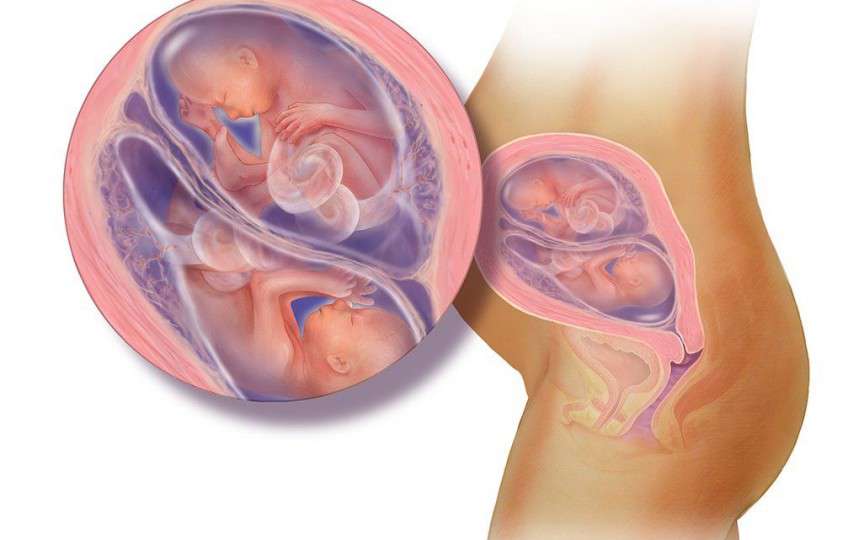 Dezvoltarea intrauterină a gemenilor lună după lună