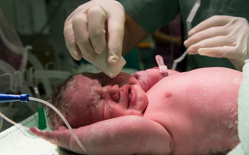 Forma capului nou-născutului – ce este normal și când să mergi la medic