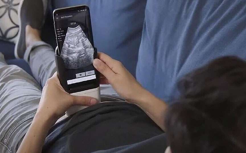 Gravidele vor putea face singure ecografii cu smartphone-ul – noua eră a îngrijirii prenatale