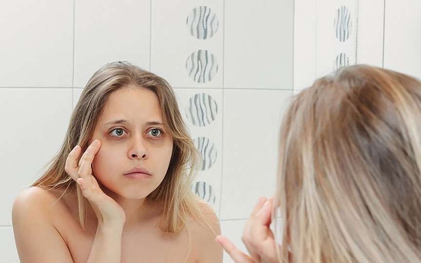 Cum să scapi de cearcăne: cauze, tratamente și prevenție