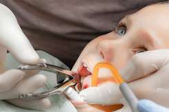 Dacă nu dor dinții, înseamnă că totul e în regulă? Cele mai frecvente întrebări adresate stomatologului pediatru