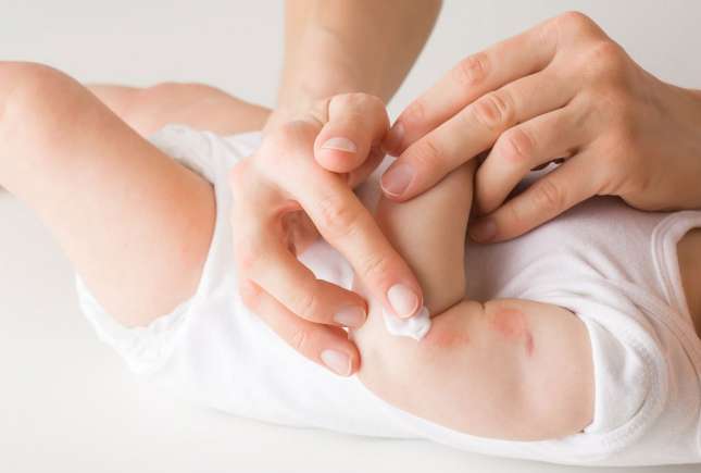 Dermatofitoza la copii – simptome, cauze și tratament eficient