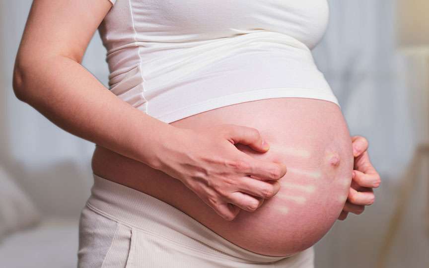 Psoriazisul în sarcină – efecte asupra mamei și opțiuni sigure de tratament