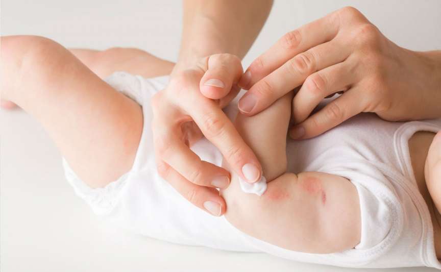 Dermatofitoza la copii – simptome, cauze și tratament eficient