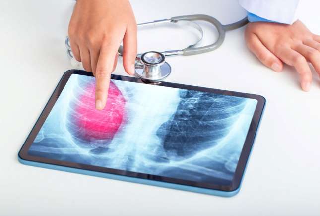 Screening pulmonar gratuit în raionul Ialoveni: program și localități disponibile între 29 iunie și 3 iulie