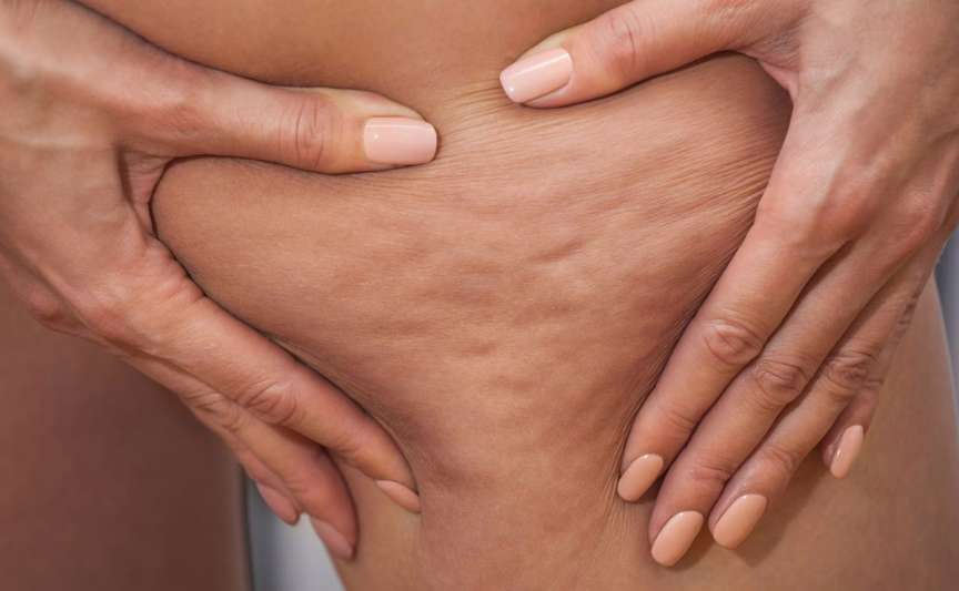 Iată cum revistele de frumusețe au creat o problemă pentru milioane de femei
