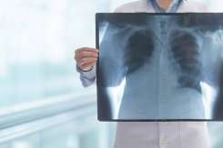 Screening pulmonar gratuit în raionul Ialoveni, 6-8 iulie: program pe localități