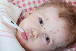 Copilul cu varicelă poate fi scăldat? Ce recomandă medicii pediatri
