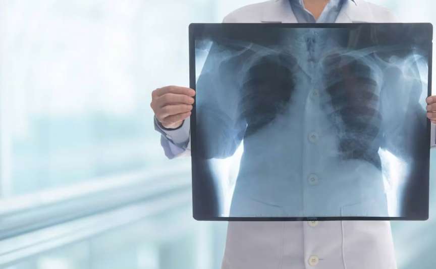 Screening pulmonar gratuit în raionul Ialoveni, 6-8 iulie: program pe localități