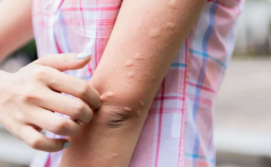 Măsuri de protecție împotriva țânțarilor, în timp ce virusul West Nile se extinde în Europa