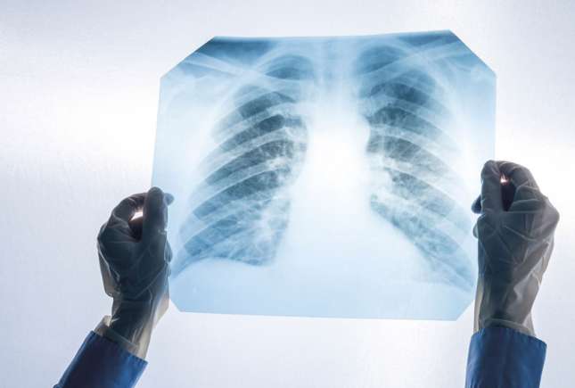 Screening pulmonar gratuit la Bălți: program pentru 5-9 octombrie