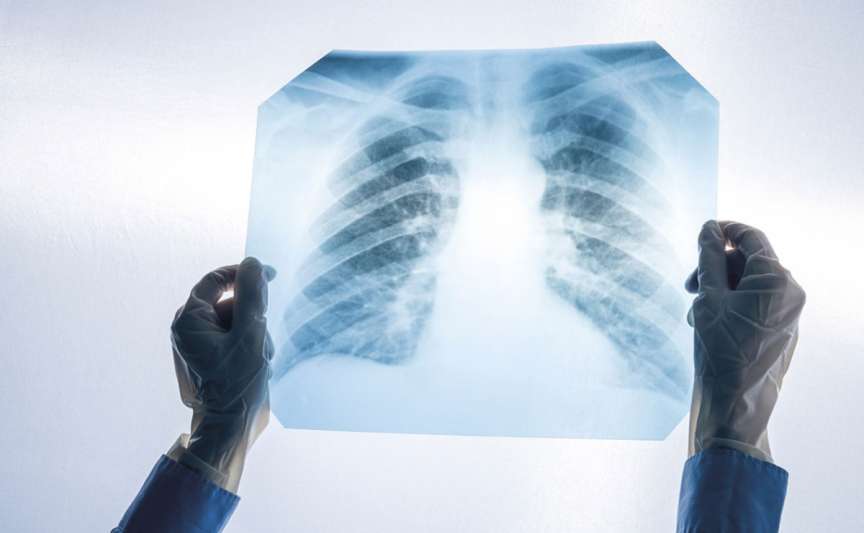 Screening pulmonar gratuit la Bălți: program pentru 5-9 octombrie